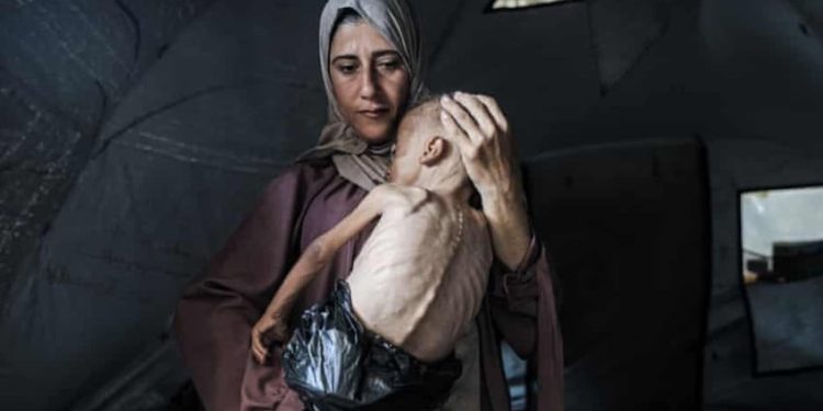 Hamas Serukan Protes Global untuk Menghentikan Kejahatan Kelaparan di Gaza