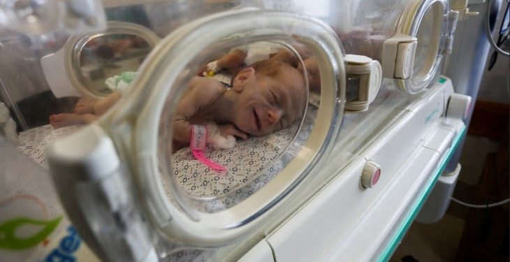 Lebih dari 100 Bayi Prematur di Gaza Terancam Tewas karena Rumah Sakit Kehabisan Energi