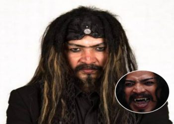 Limbad Ditahan Imigrasi Arab Saudi Diduga Karena Gigi Taringnya, Netizen Berkomentar Unik
