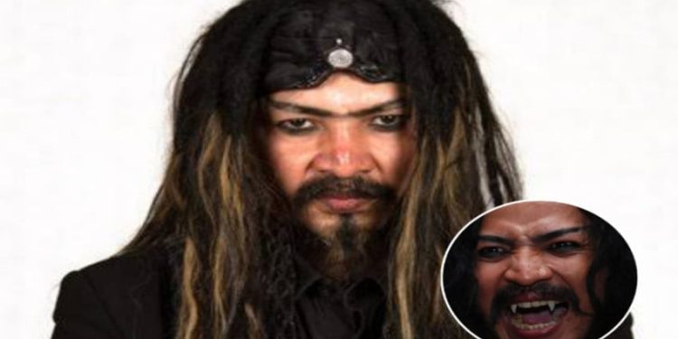 Limbad Ditahan Imigrasi Arab Saudi Diduga Karena Gigi Taringnya, Netizen Berkomentar Unik